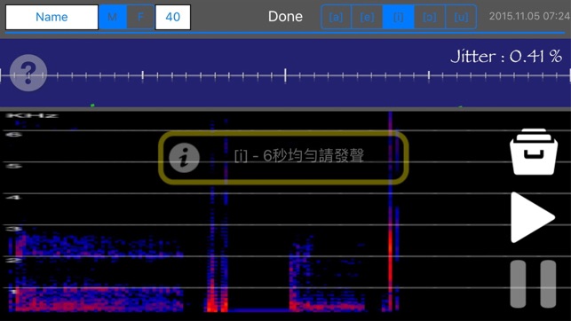 語音穩定性試驗(圖3)-速報App