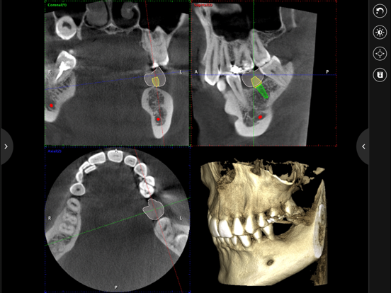Planmeca mRomexisのおすすめ画像4