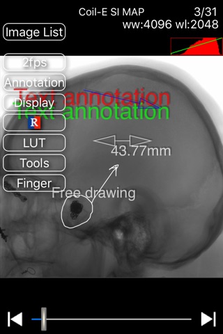 iMedViewer screenshot 2