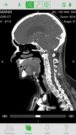 OsiriX HDのおすすめ画像1