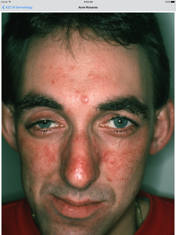 Screenshot #6 pour A2Z of Dermatology