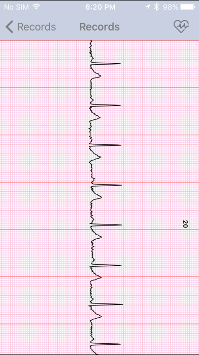Screenshot #1 pour Sanitas ECG Manager