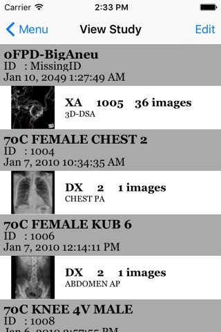 iMedViewer screenshot 3