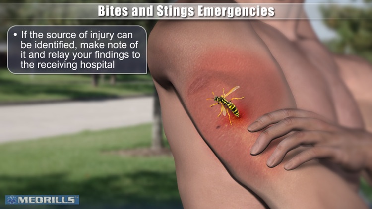 Medrills: Bite and Sting Emergencies