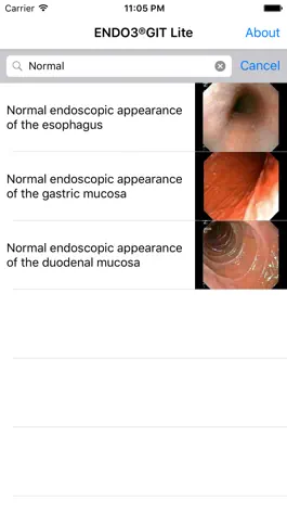Game screenshot ENDO3® Atlas of Gastrointestinal Endoscopy - Lite hack