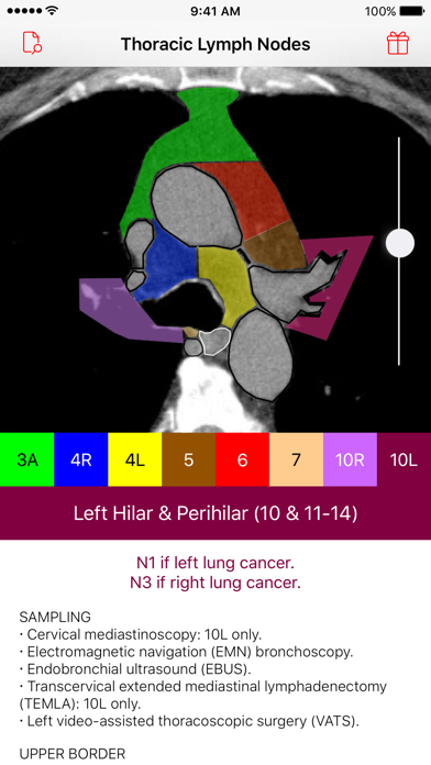 Thoracic Lymph Node Map Screenshot