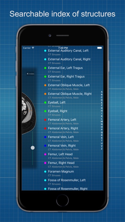 X-Anatomy Pro