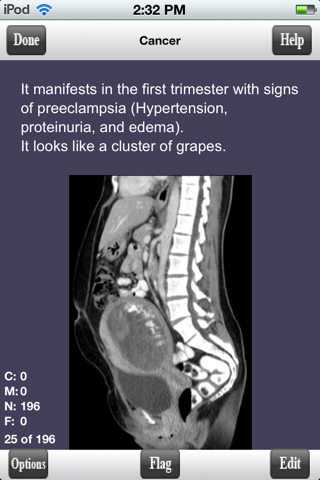 COMLEX Level 1 Flashcards Lite screenshot 3