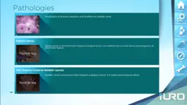 Game screenshot iURO Oncology hack