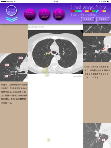 Challenge Note Lung CT screenshot 2