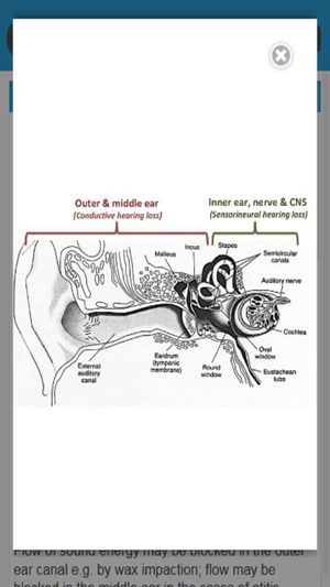 Audiology and Hearing Aids for Otolaryngologist(圖3)-速報App