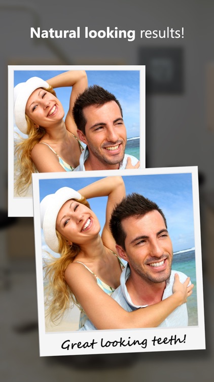 Teeth Whitener, Whiten and Brighten Your Teeth in Photos!