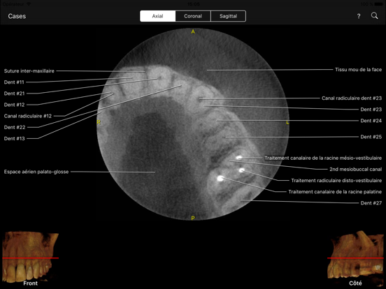 Screenshot #5 pour CBCT