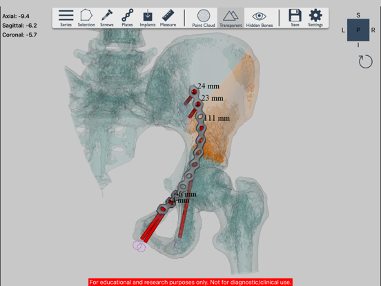 Screenshot #6 pour Ossa 3D