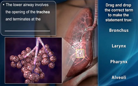 Medrills: Pediatric Medical Emergencies screenshot 2