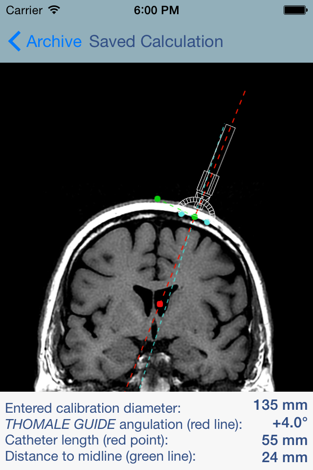 Thomale Guide Application