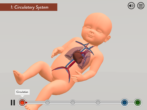 Screenshot #5 pour Child Heart Surgery