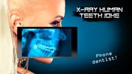 Game screenshot X-Ray Human Teeth Joke mod apk