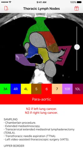 Game screenshot Thoracic Lymph Node Map hack