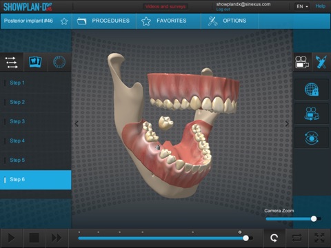 Showplan-DX - Dental screenshot 2