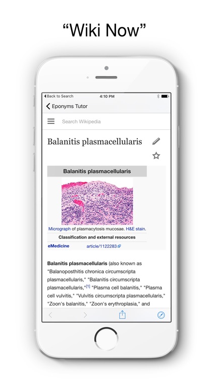 Eponyms - Disease Picture and Medical Tutor screenshot-4