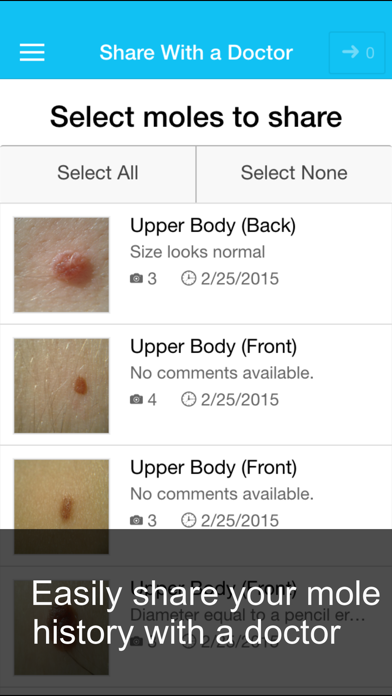 Skin Cancer App - MySkinPal - Map your skin moles Screenshot 5