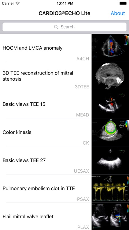 CARDIO3® Comprehensive Atlas of Echocardiography - Lite