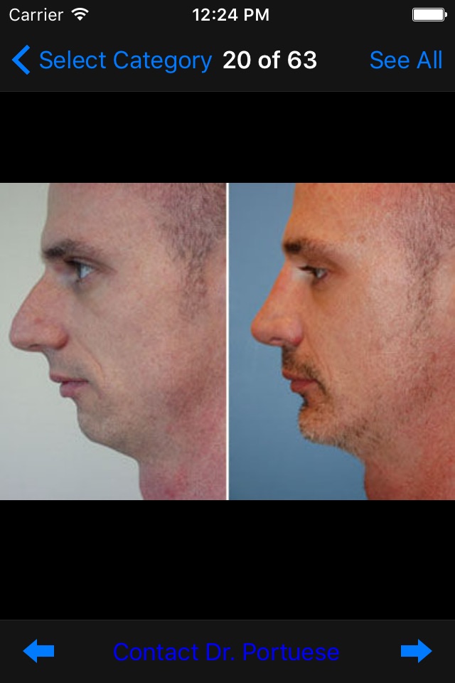 Plastic Surgery & Rhinoplasty screenshot 3