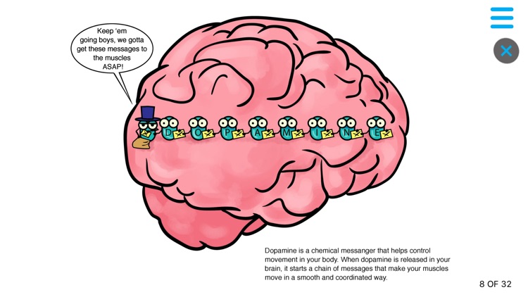 Parkinson's Xplained