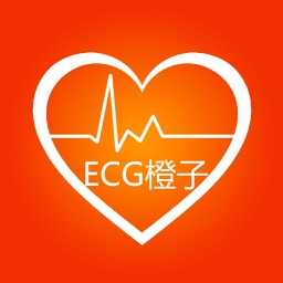 橙子心电图