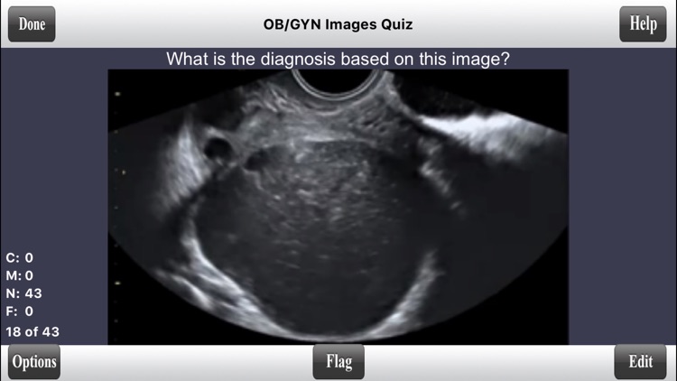 ARDMS OBGYN Ultrasound Flashcards for ARDMS OB/GYN Board Review