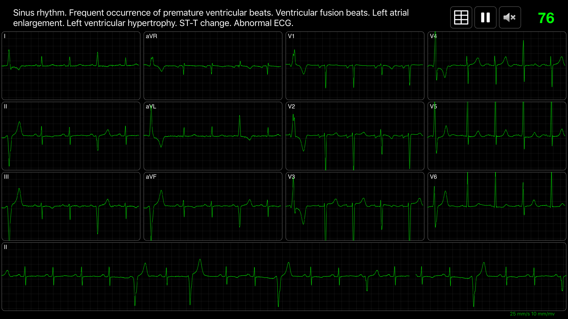 ECG Pro | Road to Mastery screenshot 24
