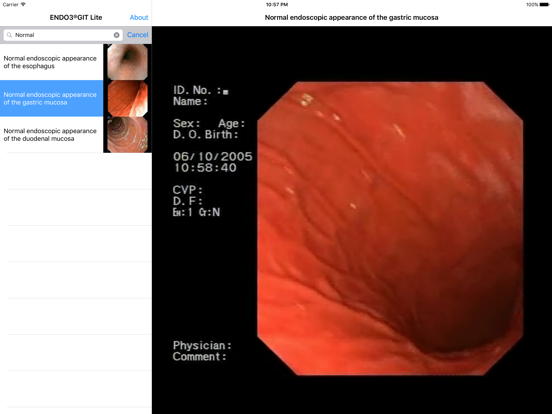 Screenshot #5 pour ENDO3® Atlas of Gastrointestinal Endoscopy - Lite