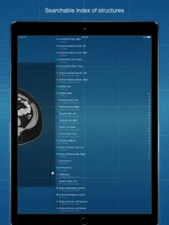 X-Anatomy Basic iPad image 2