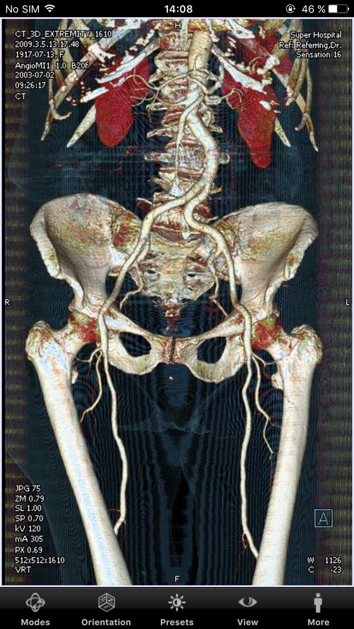 syngo®.via WebViewer