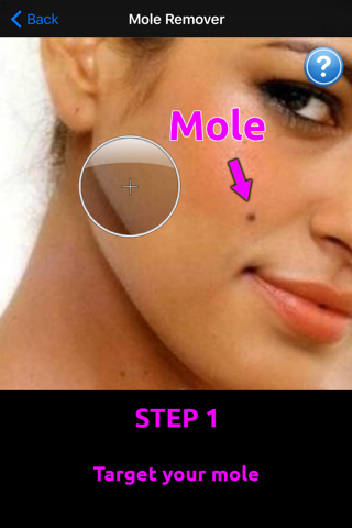 Mole Remover - Erase a blemish screenshot 2