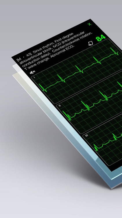 ECG Books Pro - Abnormal ECG (EKG) Case Database