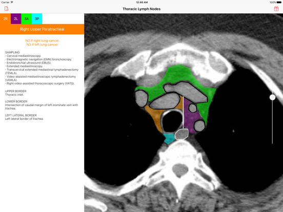 Screenshot #6 pour Thoracic Lymph Node Map