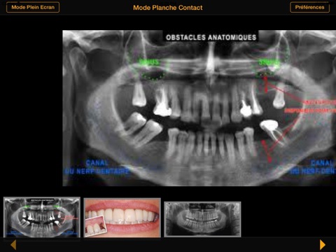 Dental iMiroir screenshot 2