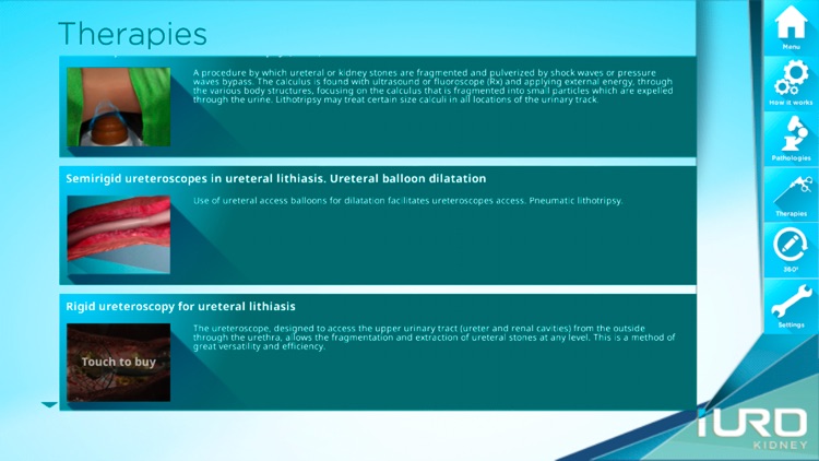 iURO Kidney Lite screenshot-3