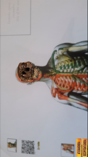 Cervical