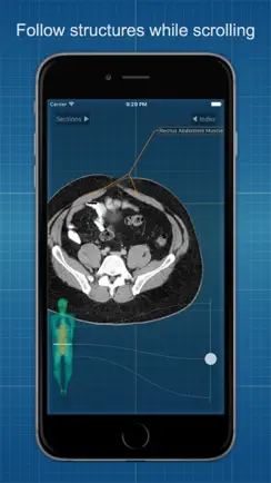 X-Anatomy Basic iPhone image 3