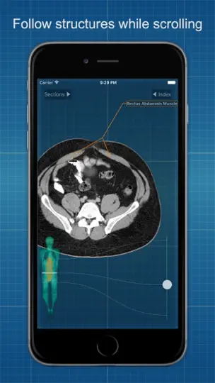 X-Anatomy Basic iPhone Screenshot 3