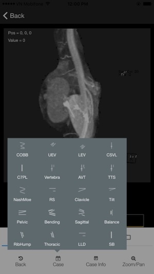 Orthopedic(圖4)-速報App