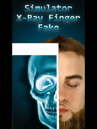 Captura 1 Simulator X-Ray Bone Fake iphone