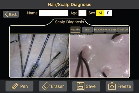Diagnosis