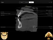 cbct ipad resimleri 1