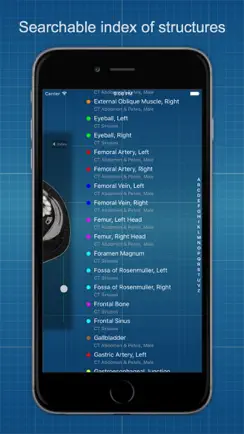 X-Anatomy Basic iPhone image 4