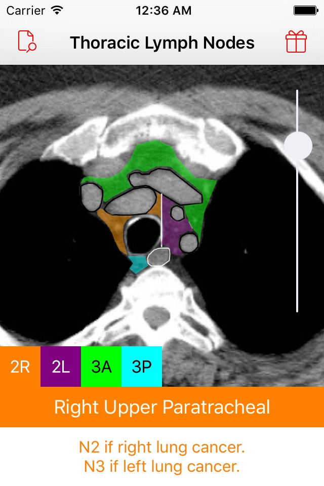 Thoracic Lymph Node Map screenshot 3