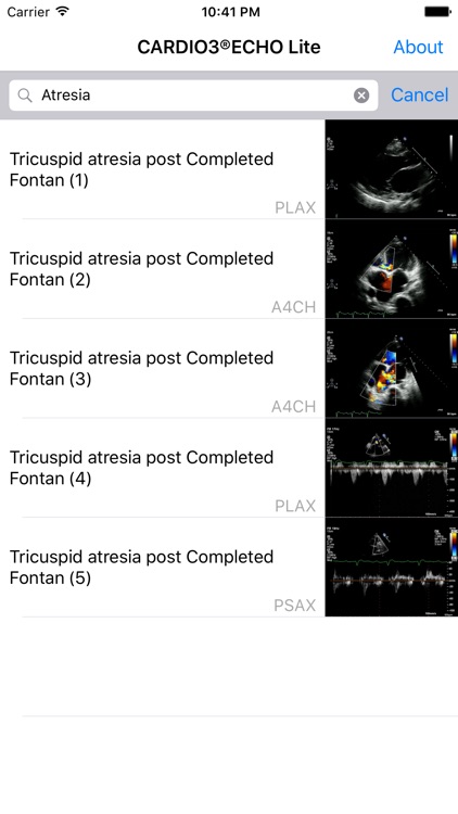 CARDIO3® Comprehensive Atlas of Echocardiography - Lite